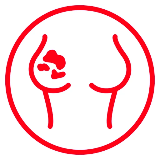 Maladies mammaires.webp